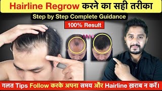 100 Result  Hairline Growth Tips 2023  Receding Hairline से छुटकारा [upl. by Upton468]