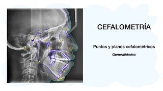 PUNTOS CEFALOMÉTRICOS  Cefalometría 💀🦷✅ [upl. by Tem386]