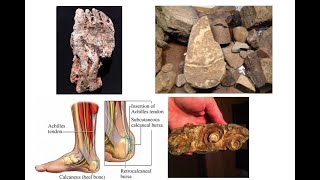 A New Species of Engineered Hominids shows Darwinism and His Origin of Species Likely to be Wrong [upl. by Nomyad584]