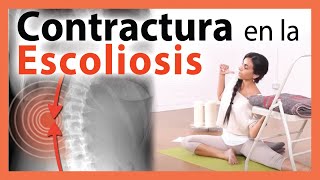 🛑 Dónde está la CONTRACTURA en la ESCOLIOSIS ▶ EJERCICIO para MEJORAR Yoga Terapéutico 😲 WOOOW [upl. by Aneryc356]