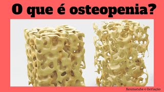 Osteopenia o que é [upl. by Leavitt]