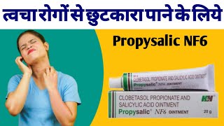 Propsaslic NF6 Ointment Uses Benefits And Side Effects In hindi  Clobetasol Propionate Cream [upl. by Coulombe]