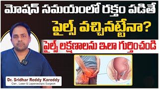 పైల్స్ లక్షణాలు  Signs and Symptoms of Piles  Piles Treatment in Telugu  Treatment Range Hospital [upl. by Krystyna758]