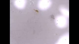 Copepods under a 200x Microscope [upl. by Gawen300]