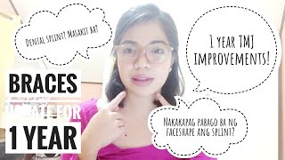 Vlog 10 QampA pt2 1 Year of braces TMJ improvements  splint experience Hugis bigas na face shape [upl. by Martel40]