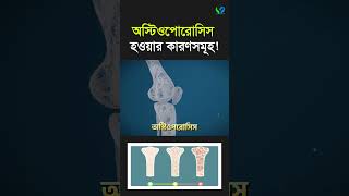 অস্টিওপোরোসিস বা হাড় ক্ষয় যেসব কারণে হয়। Osteoporosis [upl. by Akinorev]