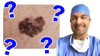 Melanoma Review for the ABSITE  Questions and Answers [upl. by Dedra]