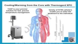 Hypothermia for acute treatment of ischemic stroke by Patrick Lyden MD [upl. by Adnilym]