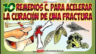 10 Remedios Caseros para Acelerar la Curación de una Fractura Hueso  Como Soldar Hueso Roto🤕🤕 [upl. by Auberbach]