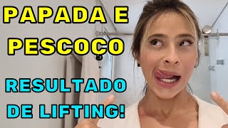 ACABE COM A PAPADA E REDUZA A FLACIDEZ NO PESCOÇO [upl. by Pavior]