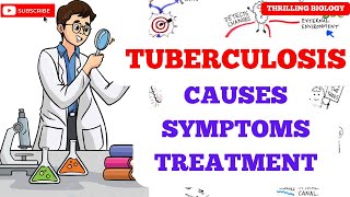 Tuberculosis Causes Symptoms Treatment [upl. by Annibo]