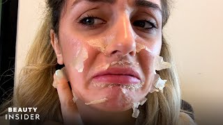 What It’s Like To Get A Chemical Peel For Acne Scars  Beauty Explorers  Beauty Insider [upl. by Venezia]