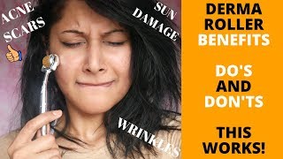 HOW TO USE A DERMA ROLLER  CORRECT METHOD  10 MICRONEEDLING SIDE EFFECTS amp THE RIGHT SIZE [upl. by Naaitsirhc]