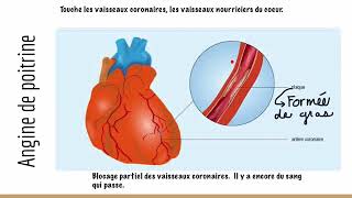 L’hygiène du système cardiovasculaire [upl. by Roon622]