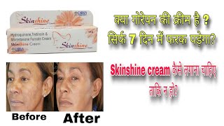 Skinshine Cream  Skin Shine Cream  Skinshine Cream Uses In Hindi [upl. by Sparky860]