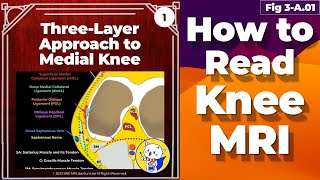 Fig 3A01 ThreeLayer Approach to Medial Knee [upl. by Mattox]