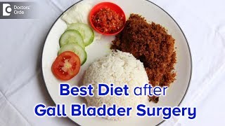 Diet after Laparoscopic Cholecystectomy Gall bladder surgery  Dr Nanda Rajaneesh [upl. by Uv21]