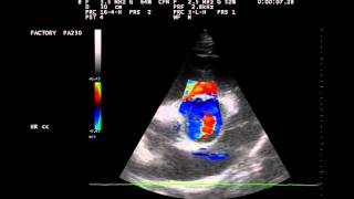Herzultraschall Aortenklappeninsuffizienz beim Pferd [upl. by Publea880]