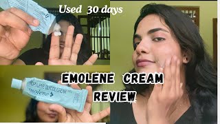 ഒരു മാസം Emolene Cream ഉപയോഗിച്ചു 👀 എന്റെ Experience 💯 Reaview 👍🏻 [upl. by Sherrer]