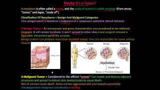 111P  What is a tumor Classification of Neoplasms  Benign and Malignant [upl. by Wolfgang]