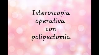 Isteroscopia operativa con polipectomia asportazione di un polipo endometriale La mia esperienza [upl. by Ames]