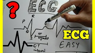 How to Read ECG in Hindi easy wayECG reading in Hindi ECG interpretation make easy ECG [upl. by Einnor795]