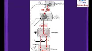 Hypothyroidie comment reconnaitre goitre debutant Glande thyroïdienne nodulaire symptomes nodule [upl. by Moll]