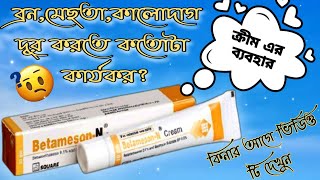 BetamesonN creamবেটামেসনএন এর কাজ কী এবং এর ব্যবহার জানুনত্বকের উজ্জ্বলতা বৃদ্ধিতে সত্যি কাজ করে [upl. by Quintana192]