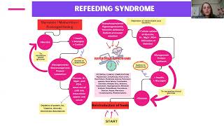 quotRefeeding syndrome in paediatric patients with severe acute malnutritionquot  Natalie Heydenrych [upl. by Gawain]