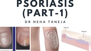 Papulosquamous disorders and PsoriasisPart1 [upl. by Jariv]