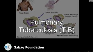 Pulmonary Tuberculosis TB Biology Lecture  Sabaqpk [upl. by Irok180]