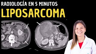 Radiología en 5 minutos Liposarcoma [upl. by Hecker511]