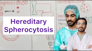 Hereditary Spherocytosis  Pathogenesis  Clinical Features  Lab Diagnosis  Treatment [upl. by Gilly]