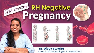 Navigating RH Negative Pregnancy  DrDivya Swetha  Ankura Hospital Madeenaguda [upl. by Millford]