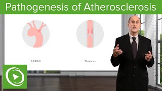 Pathogenesis of Atherosclerosis – Vascular Medicine  Lecturio [upl. by Roter470]