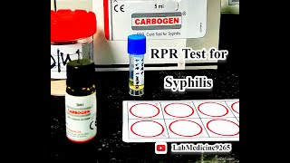 Rapid Plasma Reagin RPR Test  Serology  tulipdiagnosticspvtltdgoa [upl. by Bernardina]