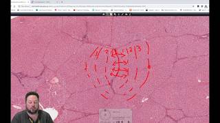 Histology101 Twitch Live Stream  Histology of the Liver Gallbladder and Pancreas [upl. by Eulau370]