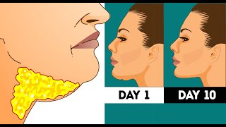 HOW TO LOSE FACE FAT  Different Ways To Slim Your Face [upl. by Zurc]