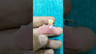 Single Unit Acrylic Removable Partial Denture 😁😁😁 [upl. by Anoniw]