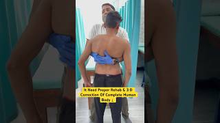 Severe scoliosis chiropractic treatment Say big no ☠️☠️ by DrRavi scoliosis chiropractic spine [upl. by Aleet]