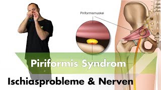 Ischialgie amp Piriformissysndrom  Nervensystem  Das solltest du über Schmerzen wissen [upl. by Penney]