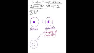 NUCLEAR CHANGES IN NECROSISAn Important Topicpathologymbbs neetpgusmleplabfmgemolecularmcq [upl. by Ynohtnael]