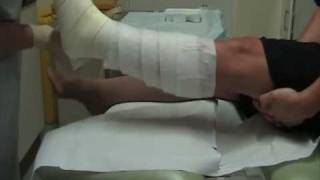 Wound Management  How to apply a single layer high compression bandage [upl. by Romeu965]