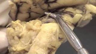 Cranial Nerves Sheep Brainmov [upl. by Valente]