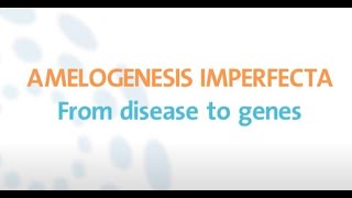 Amelogenesis imperfecta Understanding its aetiology amp genetics [upl. by Crespo248]