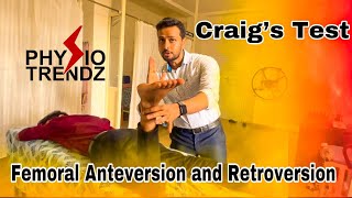 What Is Femoral Anteversion amp Retroversion and How To Test Physio trendz Physical therapy [upl. by Aleehs]