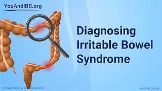 Diagnosing Irritable Bowel Syndrome [upl. by Noswad]