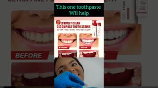 sp4 toothpaste review in Tamil  ultra whitening teethwhitening badbreathe [upl. by Barbuto]