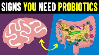 9 Signs You Need To Take Probiotics [upl. by Anigroeg341]