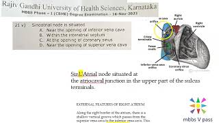 Anatomy Thorax 288 SinoAtrial Node location SinuAtrial Heart SVC Solved Question Paper MCQ [upl. by Buddie]